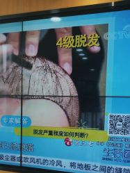 -雍禾植发全国连锁