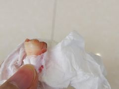 -美酷口腔牙齿矫正(江桥万达店)