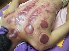 -沈师傅盲人按摩工作室(密三小区店)