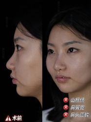 -Yestar重庆艺星医疗美容医院