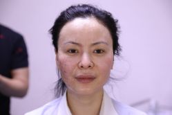 -北京叶子整形美容医院
