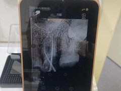-上海仁爱医院口腔科 · 种植