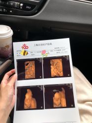 -上海百佳妇产医院