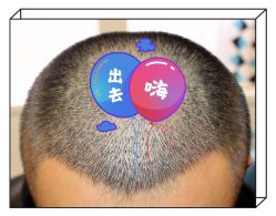 -大麦微针植发全国连锁