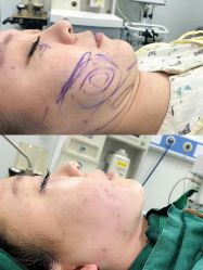 -东莞西妃整形美容医院