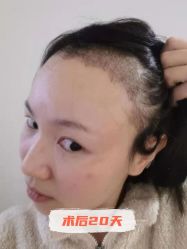 -雍禾植发全国连锁