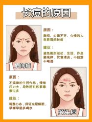 -苗方清颜痘肌研究所