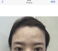 -Yestar艺星整形美容医院