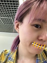 点击看大图 -L+奥拉接发烫发染发