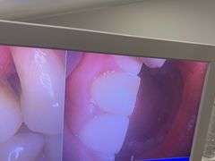 -土豆口腔(凤凰北总店)