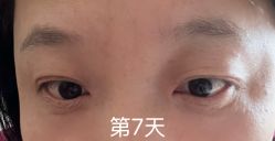 -天津健丽·去眼袋医疗美容机构