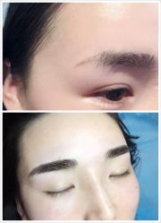 -美肤盾祛痘·问题肌头疗管理中心