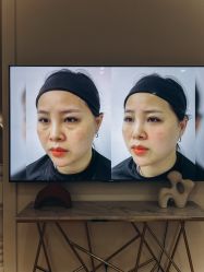 -广州健丽·去眼袋医疗美容机构