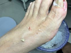 -世龙世家甲沟炎·灰指甲·嵌甲矫正·修脚(武侯区双楠店)