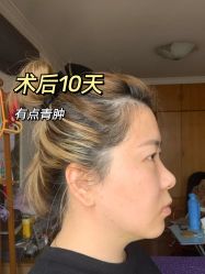-深圳艺星医疗美容医院