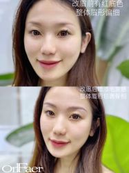 点击看大图 -OnFaer.纹眉半永久无创洗眉