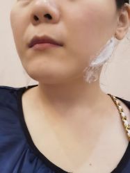 -Yestar艺星整形