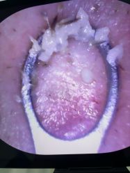 点击看大图 -凡碧诗毛孔清洁收细