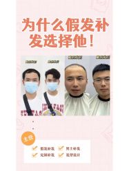 点击看大图 -极客侠男士假发定制补发