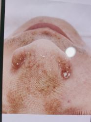 -SKIN79皮肤管理中心