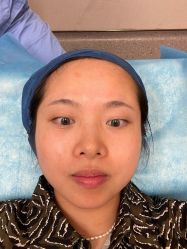 体验前-针美汇欧邦医疗美容