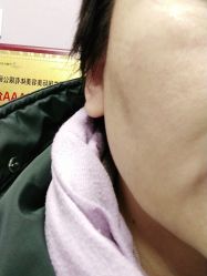 点击看大图 -薇兰专业脱毛连锁机构