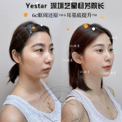 -深圳艺星医疗美容医院