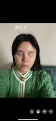 -上海时光整形外科医院