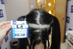 -大麦微针植发丨全国连锁