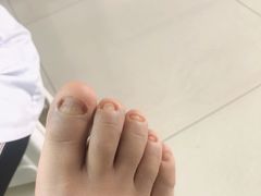 -世龙世家甲沟炎·灰指甲·嵌甲矫正·修脚(武侯区双楠店)