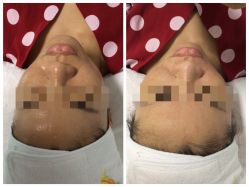 -肌理言健康美肌驻颜所
