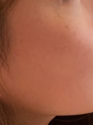 体验后-上海玫瑰医疗美容医院