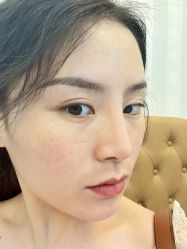 体验前-深圳广和门诊部·整形医疗美容