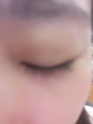 -厦门美莱整形美容医院