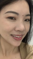 点击看大图 体验前-广州美莱医疗美容医院