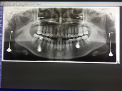 -耀光牙科(南园店)