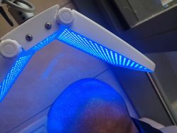 -碧莲盛·不剃发植发