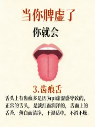 -克丽缇娜