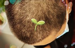 -大麦微针植发全国连锁