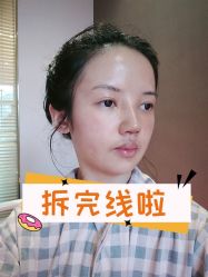 -素美医疗美容·西南眼鼻整形·修复基地