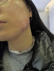 -长沙雅美医疗美容医院