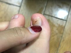 -杨一刀修脚(马连道南街店)