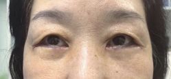 -八大处整形