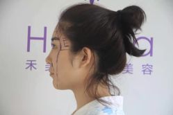 -禾美嘉医疗美容