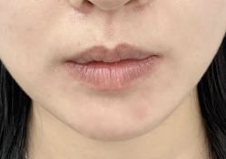 -天津健丽·去眼袋医疗美容机构