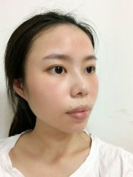 -广东韩妃整形外科医院