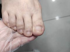 -世龙世家甲沟炎·灰指甲·嵌甲矫正·修脚(武侯区双楠店)