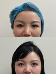 点击看大图 -广州美莱医疗美容医院