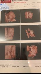 -杭州贝瑞斯美华妇儿医院·早孕·产检·儿科