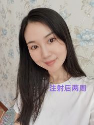 -八大处整形